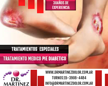 Tratamientos Pie Diabetico