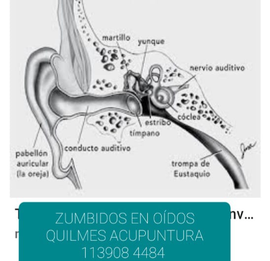 Tratamiento Zumbidos en oídos o Tinnitus Zona Sur Zumbidos en oídos o Tinnitus, Zona Sur Quilmes, Berazategui
