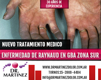 Nuevo Tratamiento de Enfermedad de Raynaud Zona Sur Quilmes, Berazategui Nuevo Tratamiento de Enfermedad de Raynaud Zona Sur Quilmes, Berazategui