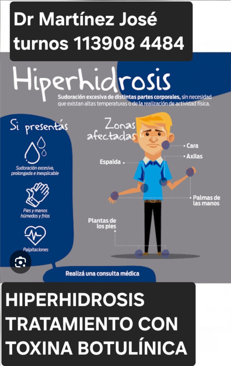 Tratamiento Medico hiperhidrosis o *SUDORACIÓN EXCESIVA* Berazategui, Quilmes, Florencio * Tratamiento toxina botulínica* en axila deja de transpirar Tratamiento Medico hiperhidrosis o *SUDORACIÓN EXCESIVA* Berazategui, Quilmes, Florencio * Tratamiento toxina botulínica* en axila deja de transpirar*